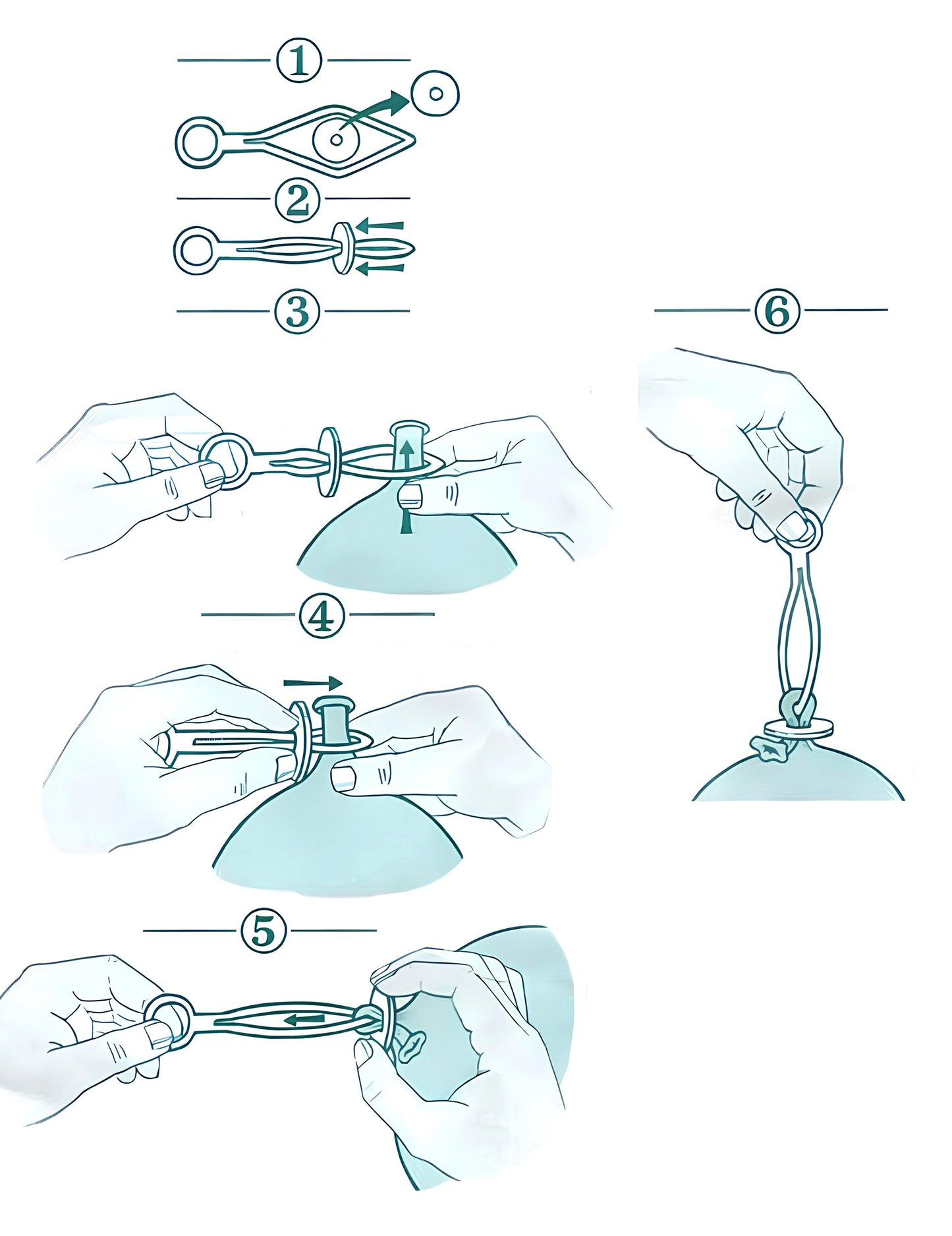 Schéma des étapes de fixation des 10 attaches ballons automatiques blanches